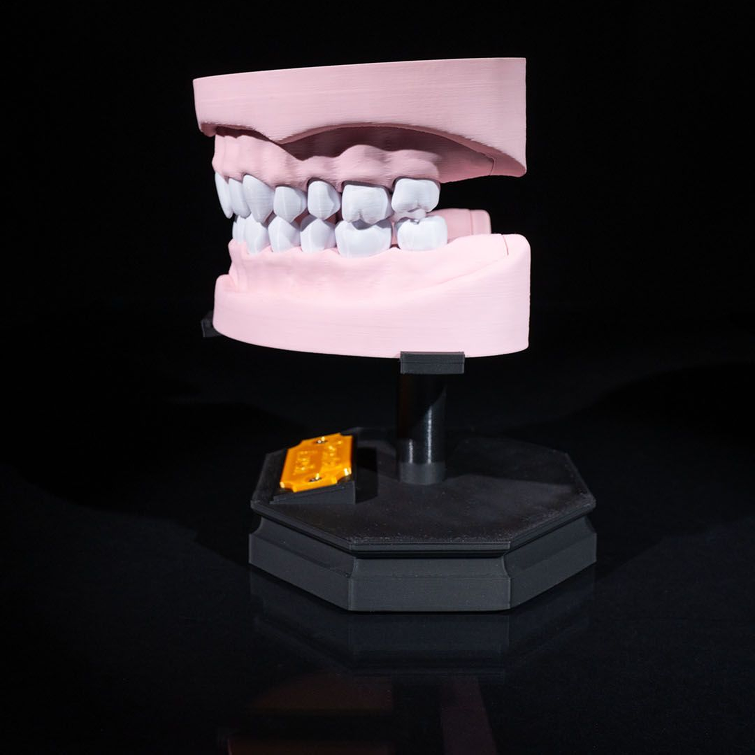 Upper and Lower Dental Arch