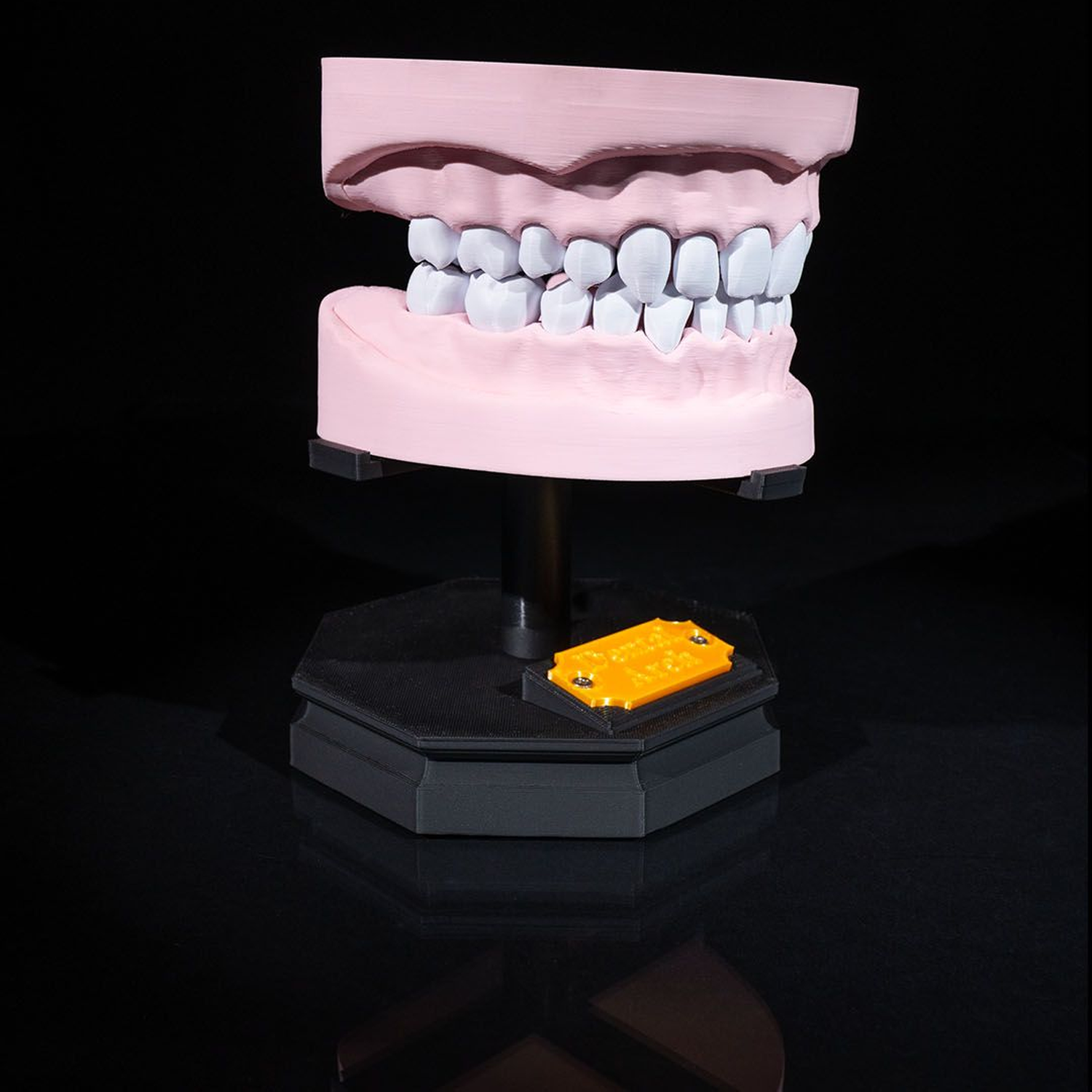 Upper and Lower Dental Arch