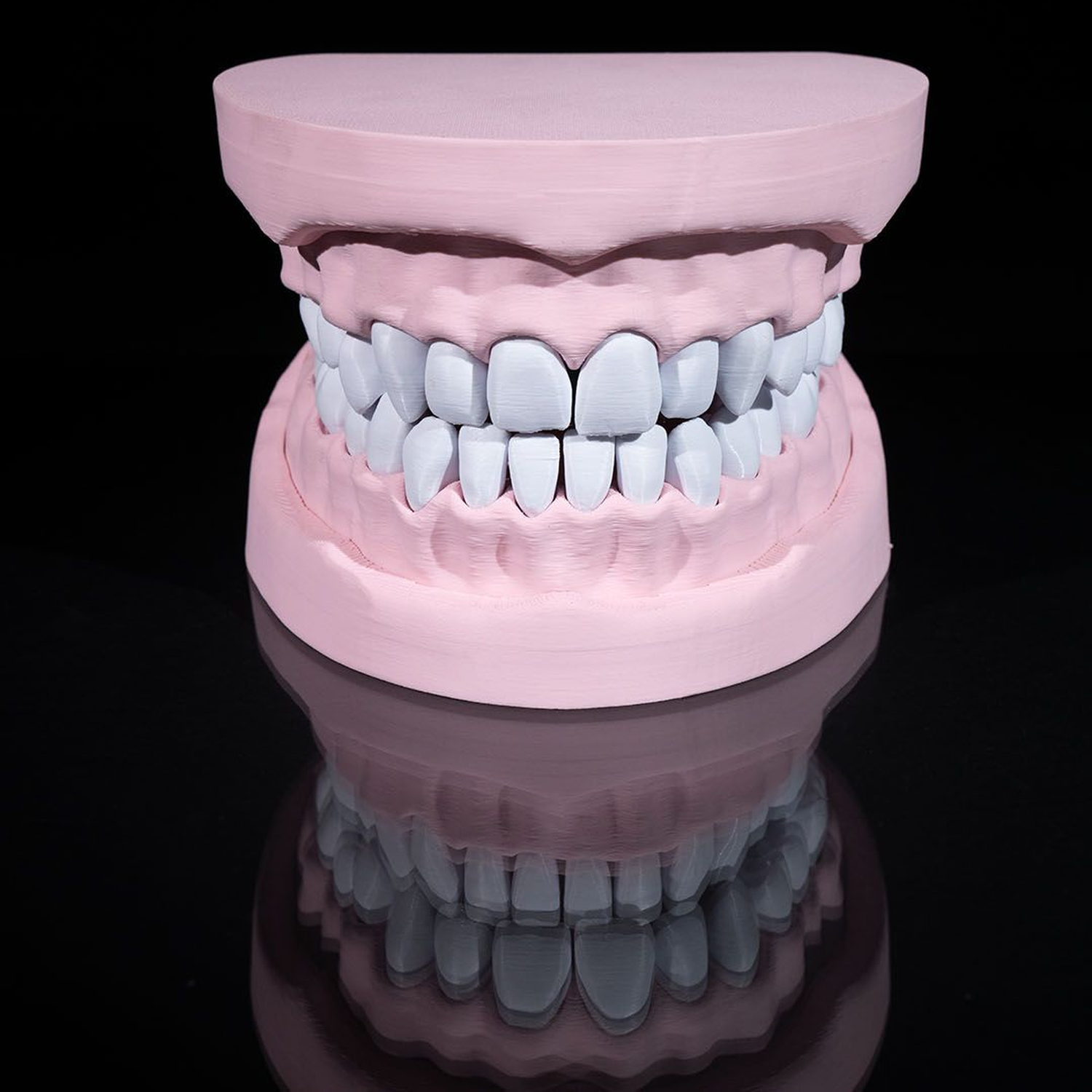 Upper and Lower Dental Arch