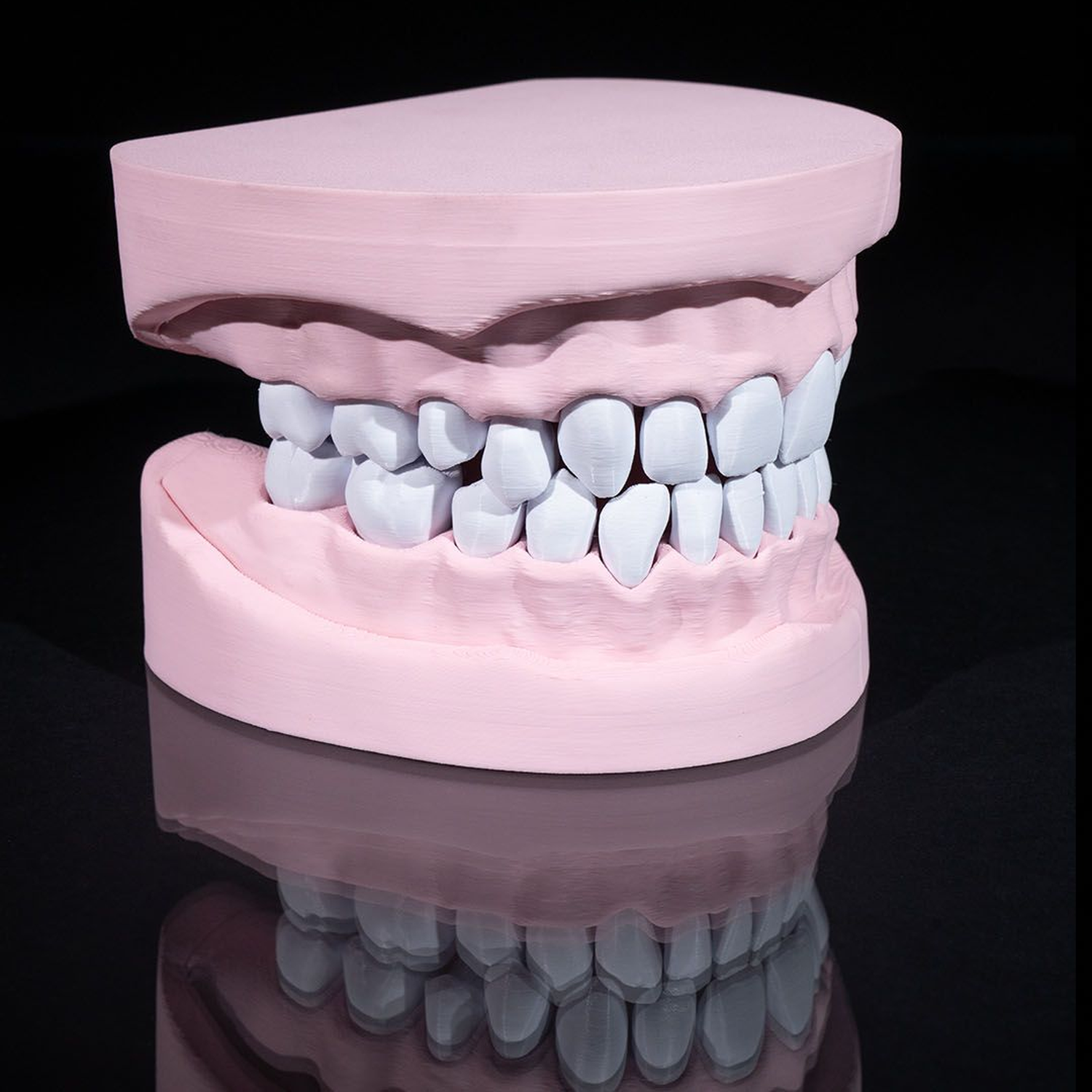 Upper and Lower Dental Arch