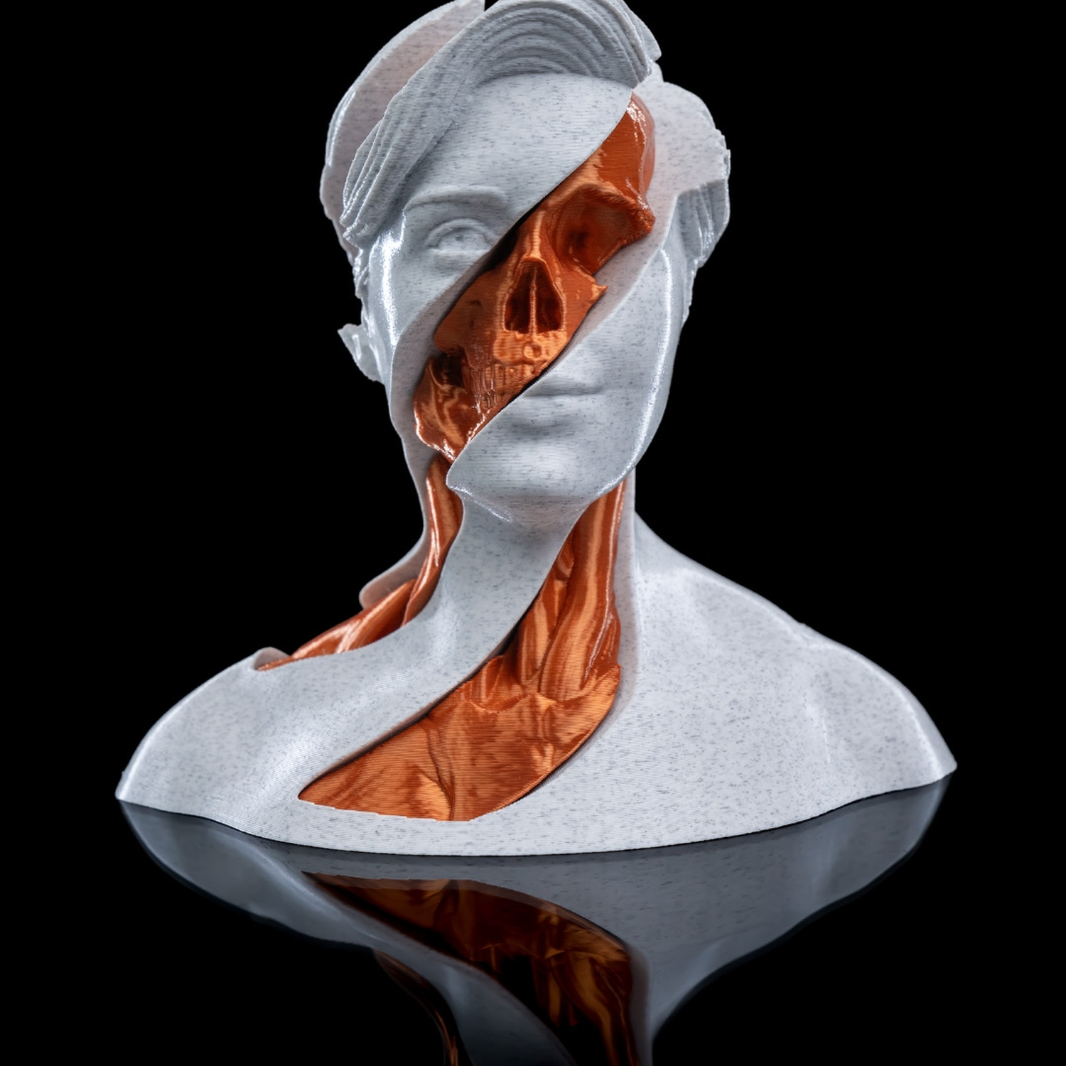 Whirls Anatomy