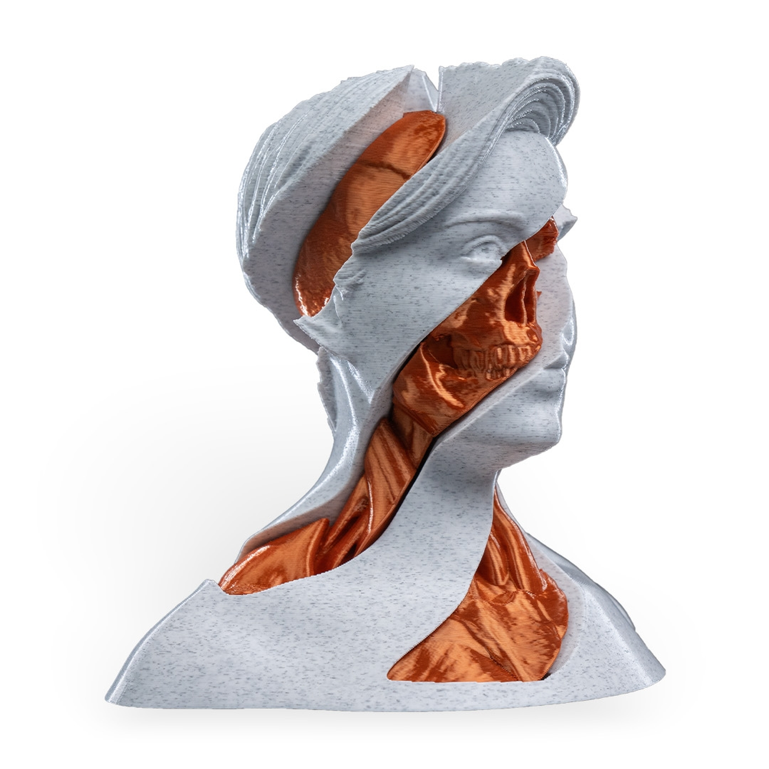 Whirls Anatomy