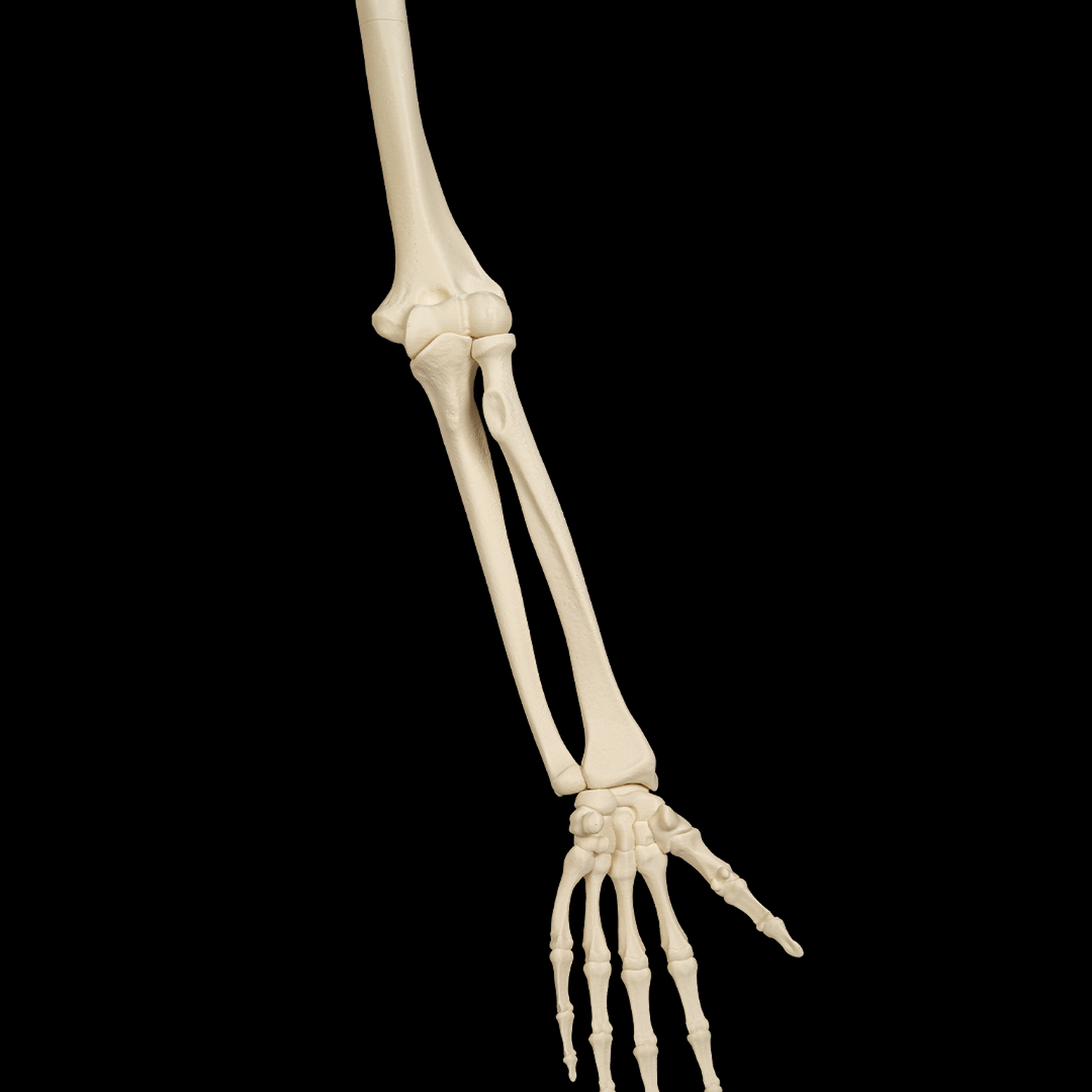 Upper Limb