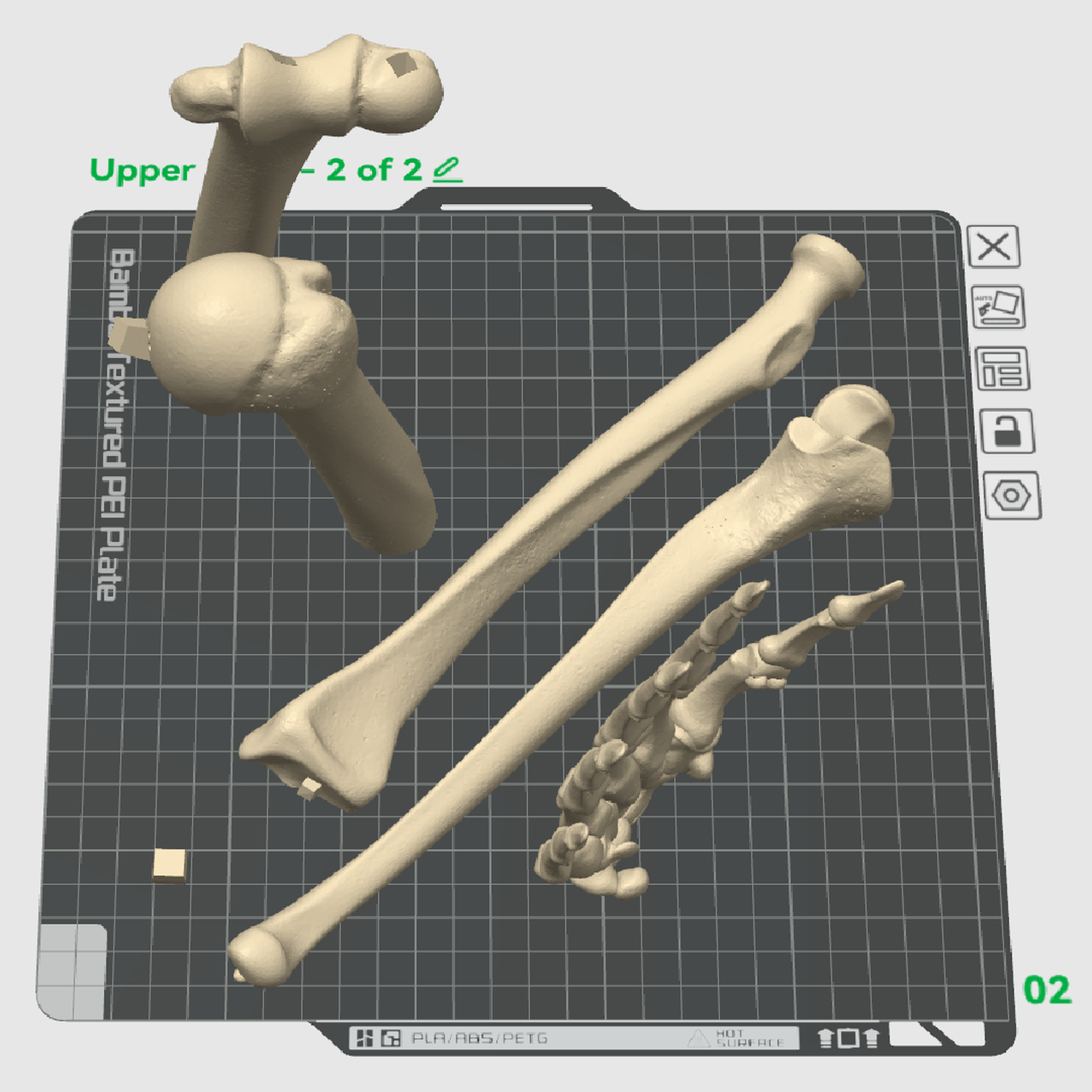 Upper Limb