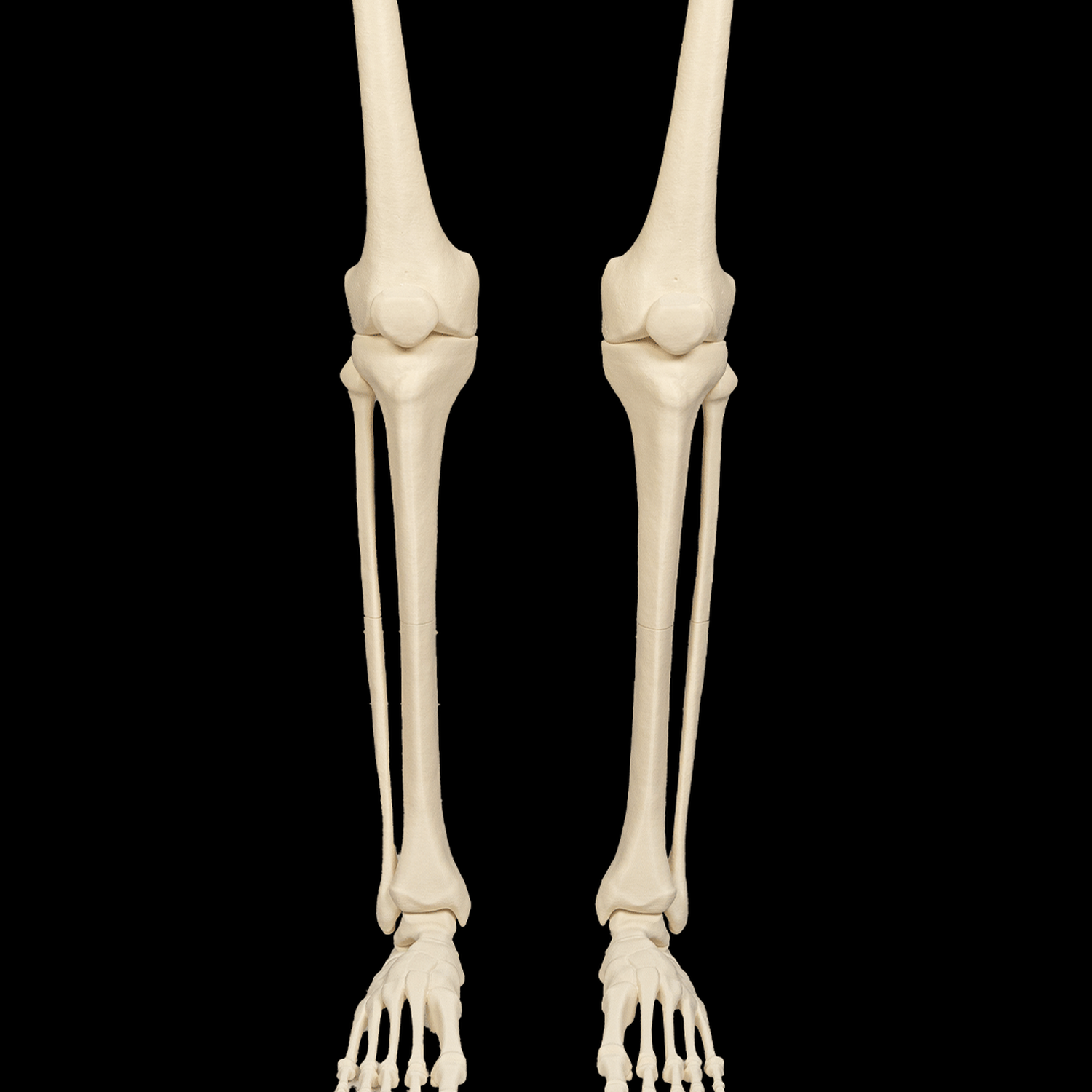 Lower Limb